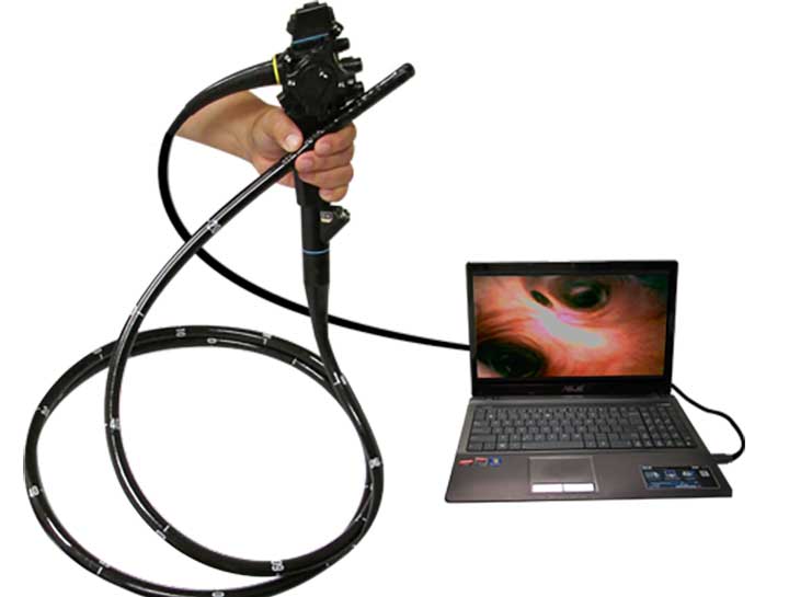 Gastroscope