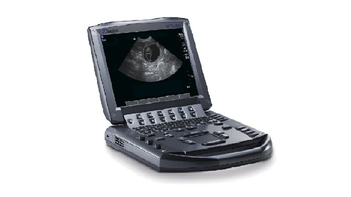 Ultrasound